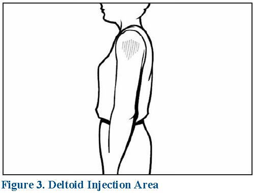 Drawing of person showing the deltoid injection area, which is an upside-down triangle in the mid-shoulder